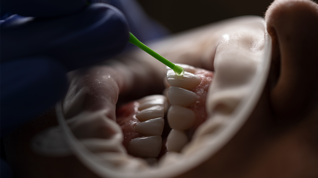 Promising Tooth Regrowth Drug Enters Human Trial Phase.